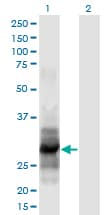 IL12A / p35 Antibody (clone 1A6)