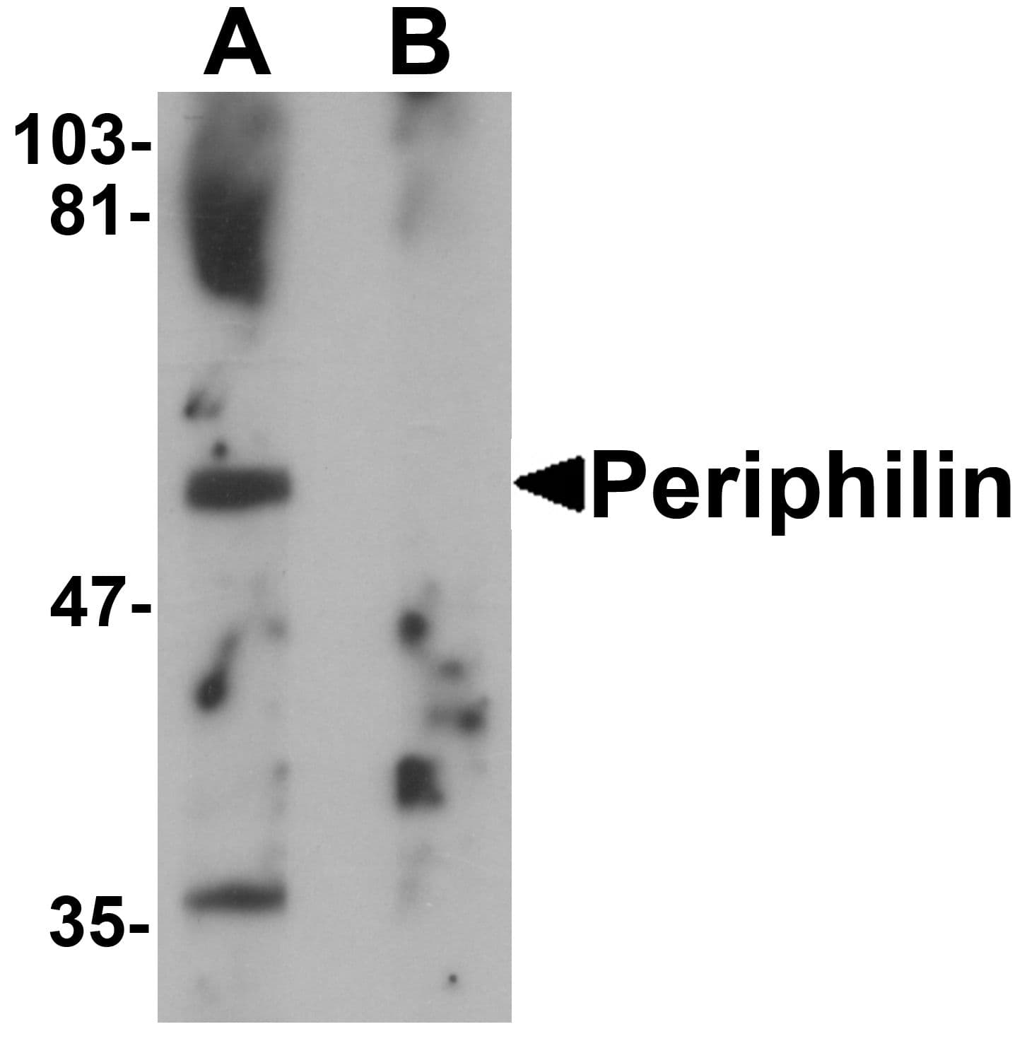 IHC-plus™ Polyclonal Rabbit anti-Human PPHLN1 Antibody (IHC, IF, WB)