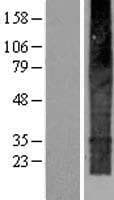 TMEM159 Protein (Over-Expression Lysate Myc-DDK (Flag))