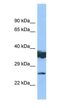 LYPLAL1 Antibody (aa97-146)