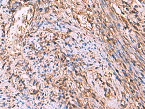RHAG Antibody