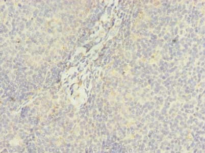 Polyclonal Rabbit anti-Human DDX42 Antibody (IHC)