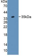 AGXT2 Antibody