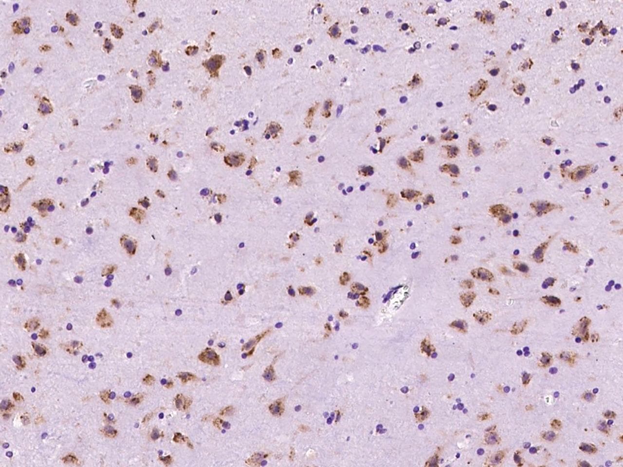 PRICKLE2 Antibody