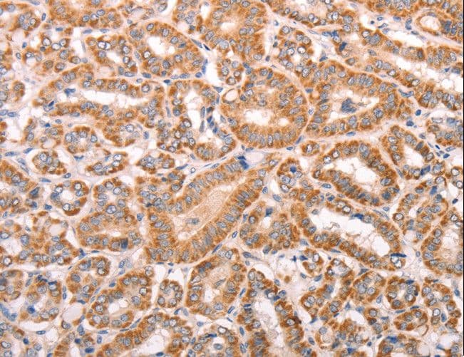 TRPV4 Antibody