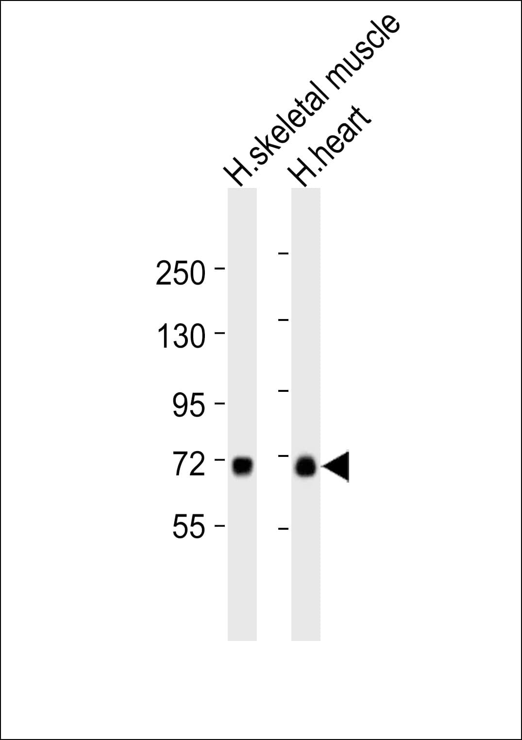 SLC25A12 / ARALAR Antibody