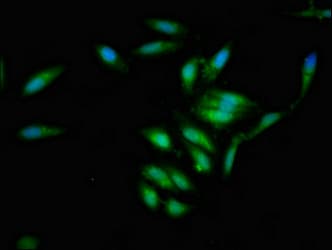 IVL / Involucrin Antibody