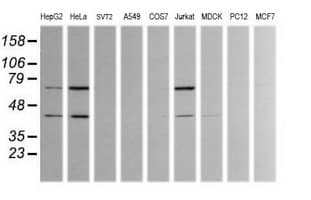 TRMT2A Antibody (clone OTI1C3)