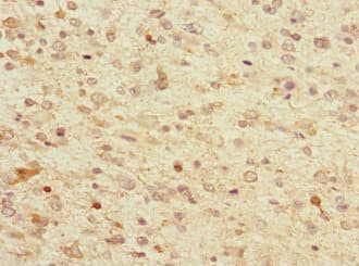 TPPP Antibody