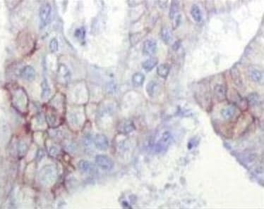 IGF1R / IGF1 Receptor Antibody (clone 3C8B1)