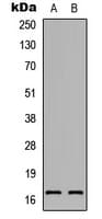 RAMP1 Antibody (Internal)