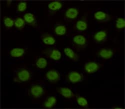 KDM1A / LSD1 Antibody
