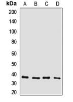Polyclonal Rabbit anti-Human GJD2 / CX36 / Connexin 36 Antibody (WB)