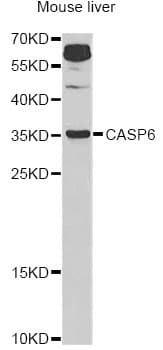 Polyclonal Rabbit anti-Human CASP6 / Caspase 6 Antibody (IHC, WB)