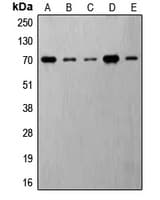 RPS6KB1 / P70S6K / S6K Antibody (phospho-Thr421)