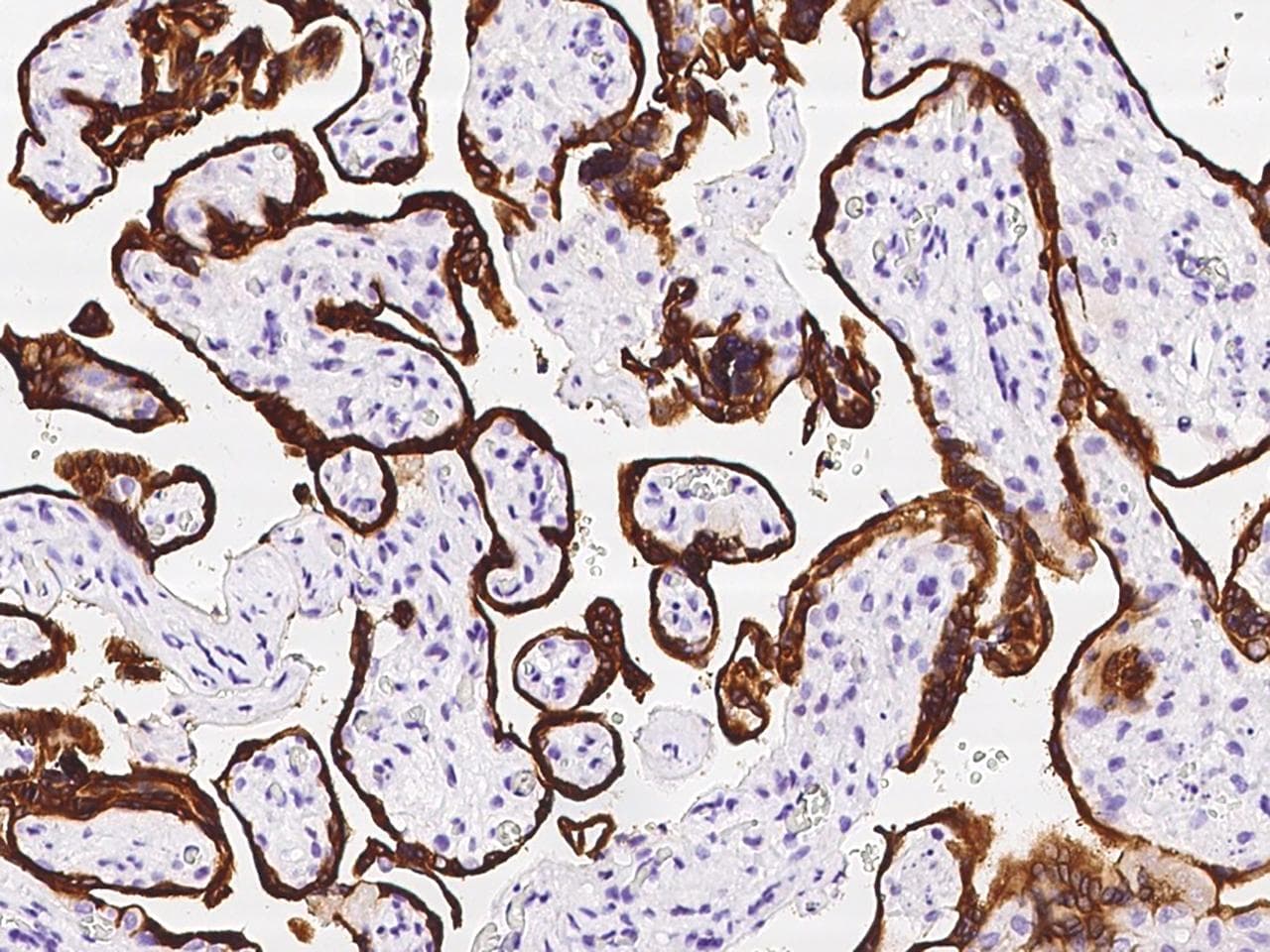 Polyclonal Rabbit anti-Human HSD3B1 Antibody (IHC)