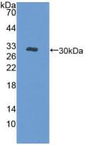 PRKD1 / PKC Mu Antibody (aa651-876)
