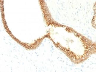 CDH1 / E Cadherin Antibody (clone CDH1/1525)