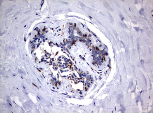 Monoclonal Mouse anti-Human FCGR1A / CD64 Antibody (clone UMAB74, IHC, WB)
