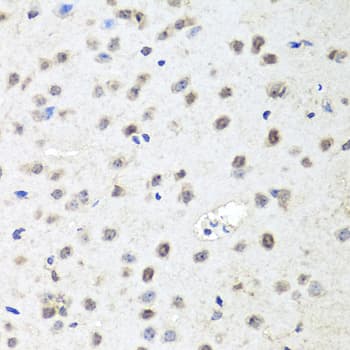 Polyclonal Rabbit anti-Human AGO2 / EIF2C2 Antibody (IHC, WB)