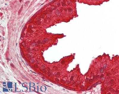 IHC-plus™ Polyclonal Rabbit anti-Human NEDD4L / NEDD4-2 Antibody (aa275-325, IHC)