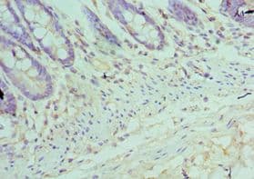 TFDP1 Antibody (aa1-290)