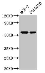 Polyclonal Rabbit anti-Human MYOC / Myocilin Antibody (IHC, WB)