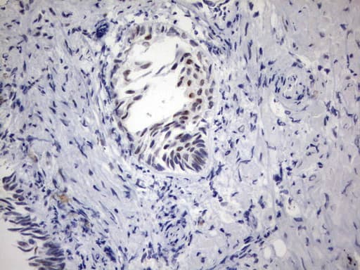 PARN Antibody (aa1-266, clone UMAB143)