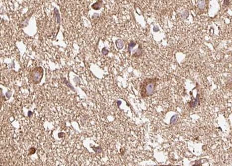 GRIN1 / NMDAR1 Antibody (phospho-Ser890)