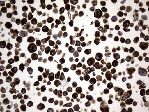 CD74 / CLIP Antibody (clone UMAB231)