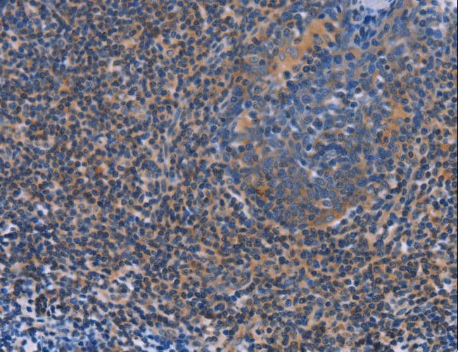 Polyclonal Rabbit anti-Human AGFG1 Antibody (IHC, WB)