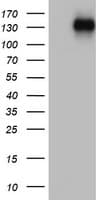 ZEB1 / AREB6 Antibody (aa1-350, clone OTI7E12)