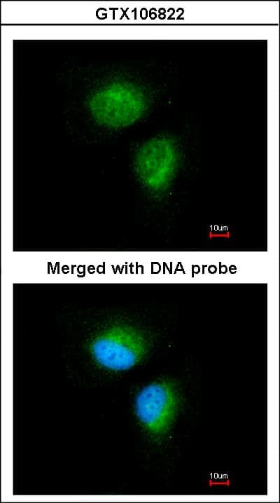MMACHC Antibody (aa1-218)