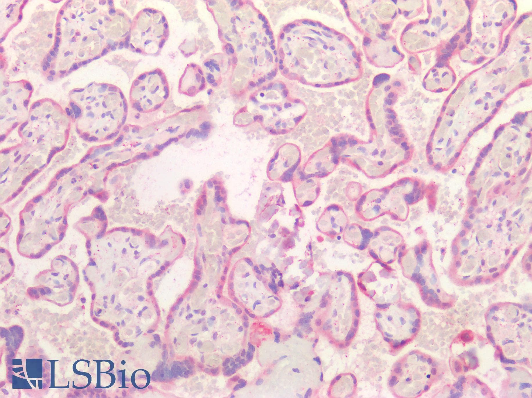 IHC-plus™ Polyclonal Rabbit anti-Human TGFB2 / TGF Beta2 Antibody (aa304-413, IHC, WB)