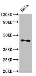 ASAH1 / Acid Ceramidase Antibody