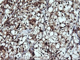 LGALS3 / Galectin 3 Antibody (clone OTI1A2)