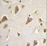 Polyclonal Rabbit anti-Human ZMYND10 Antibody (aa321-348, IHC, WB)