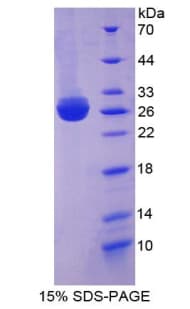 Mouse MBP / Myelin Basic Protein (Recombinant His, N-Terminal)