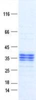 Human EPCAM Protein (Recombinant DDK,C-terminus)