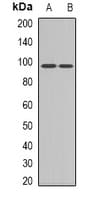 Band 4.1 / EPB41 Antibody (Internal)