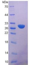 Human PLA2G6 / IPLA2 Protein (Recombinant His-T7)