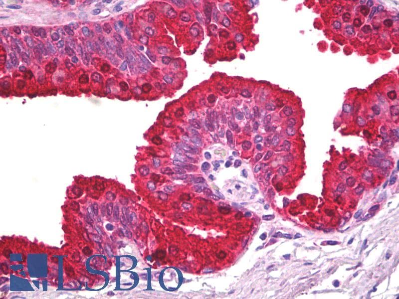 IHC-plus™ ABCA5 Antibody