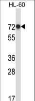 Polyclonal Rabbit anti-Human RBM39 Antibody (aa114-143, WB)
