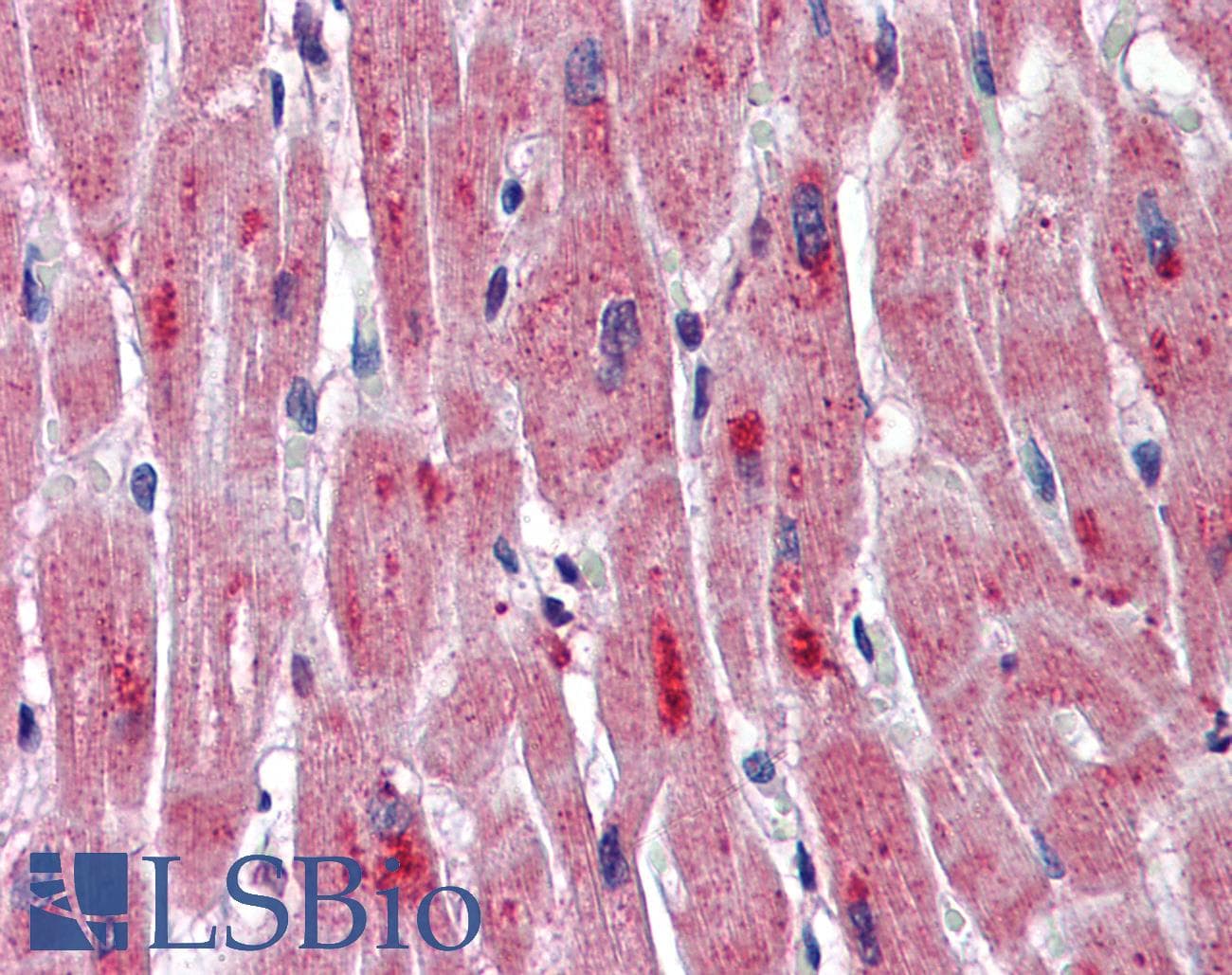 DMPK / DM Antibody (aa323-372, FITC)