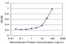 D52 / TPD52 Antibody (clone 1B6)