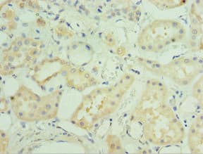 MAPK4 / ERK4 Antibody (aa348-587)