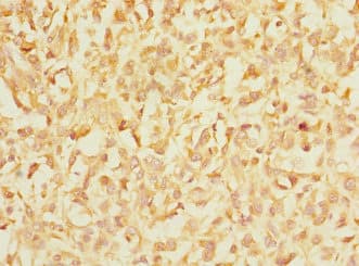 IHC-plus™ ITGAE / CD103 Antibody