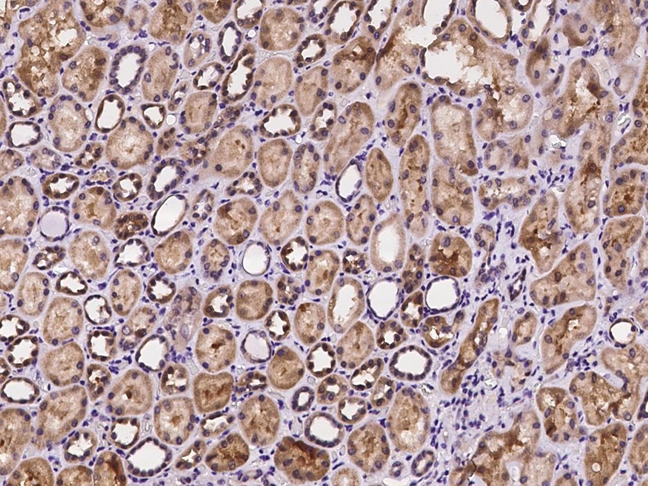 SMPD2 Antibody