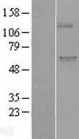 UGT1A9 Protein (Over-Expression Lysate Myc-DDK (Flag))