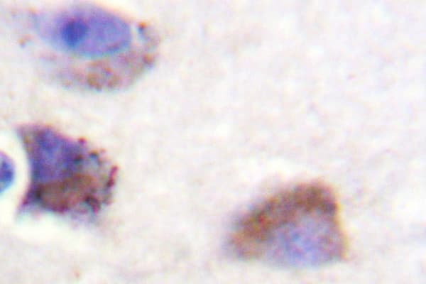 FAK / Focal Adhesion Kinase Antibody (Tyr570)